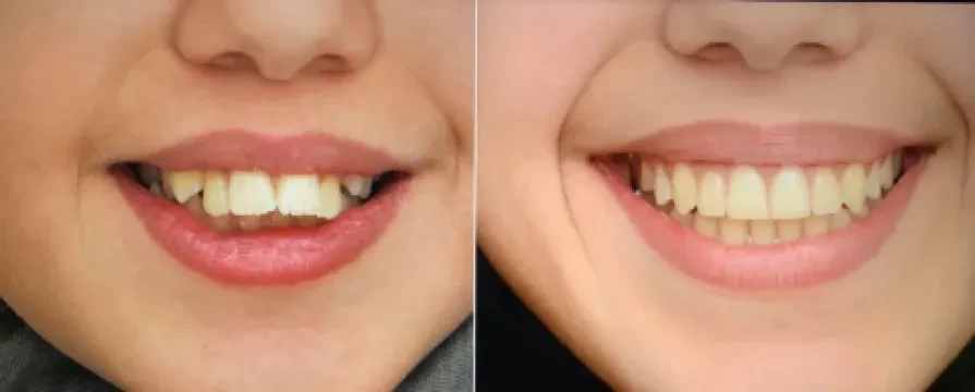 Clinique du Sourire - Dr Yassi Khalil - Orthodontiste