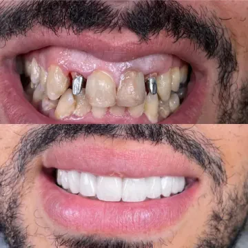 Centre dentaire Ennaji - Chirurgien-dentiste - Marrakech