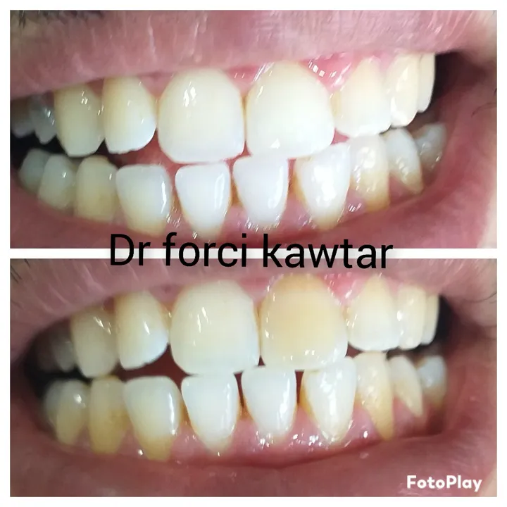 Dr. Forci Kawtar, Chirurgien-dentiste