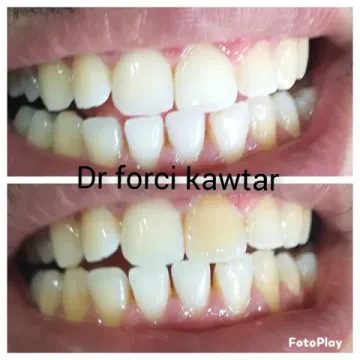 Dr. Forci Kawtar, Chirurgien-dentiste