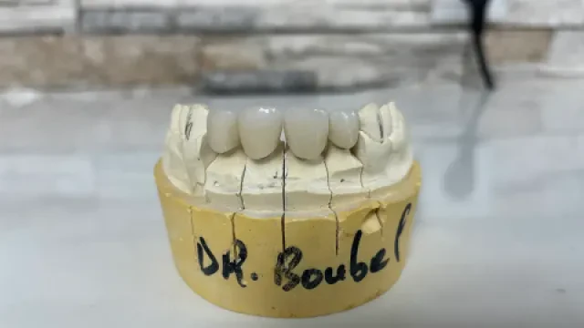Dr Boubel Tarik - Dentiste