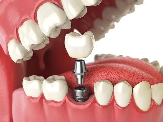 Dr Toumanari Youssef - Dentiste