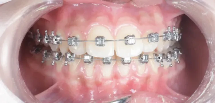 Centre dentaire Hachi - Dr Oussama Hachi