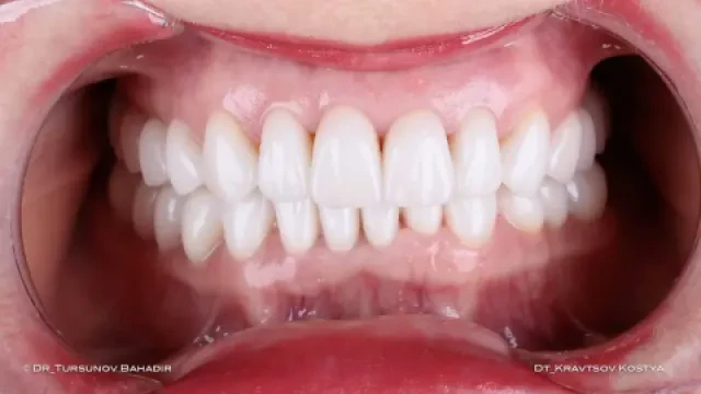 Dr Ahmed El Antouri — Chirurgien-dentiste