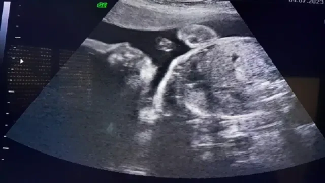 Dr Rachidi Karim Zakaria — Gynécologue