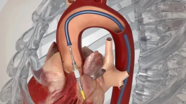 Dr Jamal-Eddine Harrag — Cardiologue interventionnel