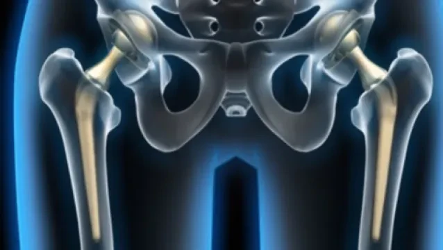 Dr Mounir Saouri - Chirurgien orthopédiste