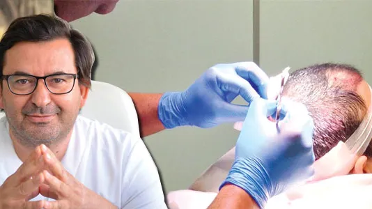 عيادة الدكتور العلمي محمد للتجميل وزراعة الشعر