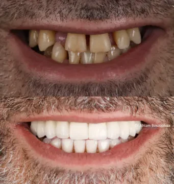Smile Marrakech Dental