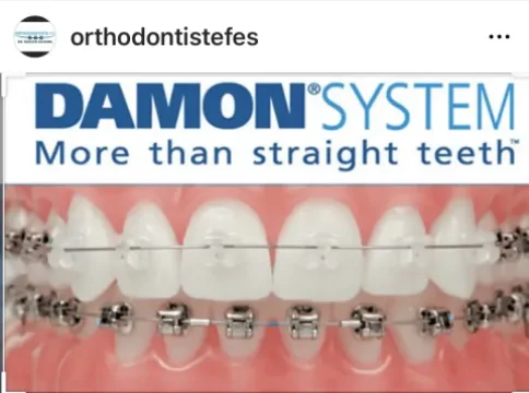 Dr Taoufik Acharki - Orthodontiste