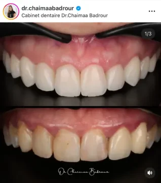 Dr. Chaimaa Badrour - Cabinet Dentaire d'Orthodontie, d'Implantologie et d'Esthétique