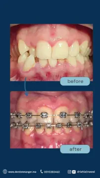 مركز الدكتورة لهلالي نوال لطب الأسنان