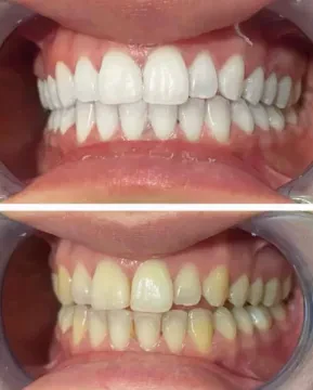 Marrakech Dental Center