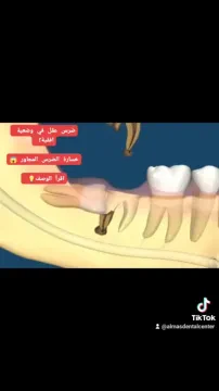 Almas Dental Center