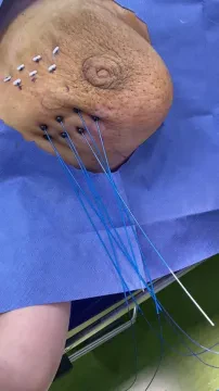 Dr Abdeljalil Jennani - Cancérologue