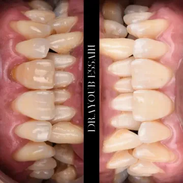 Dr Ayoub Essaïh — Dentiste à Casablanca