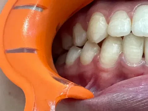 Dental Center Nia Happiness