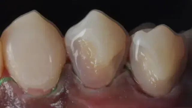 مركز الأسنان سلمان