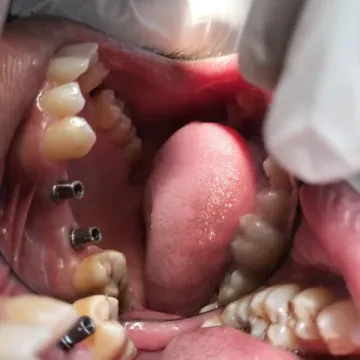 Boukhal Dental Clinic