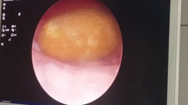 Dr Bernoussi Mohamed — Urologue