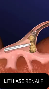 Dr Sahnoun Abderrazak — Urologue