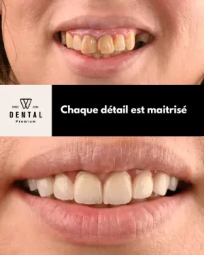 دينتال بريميوم للدكتورة سامية فرحي - طبيبة أسنان