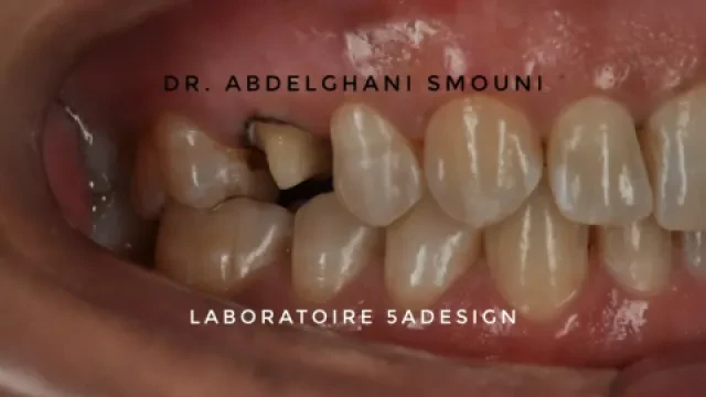 Dr Abdelghani Smouni