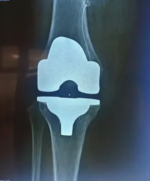 Pr Oussama El Adaoui — Traumatologue orthopédiste