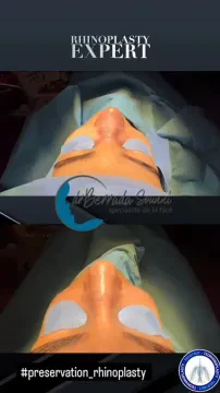 Dr Mohamed Berrada Sounni, Chirurgien esthétique