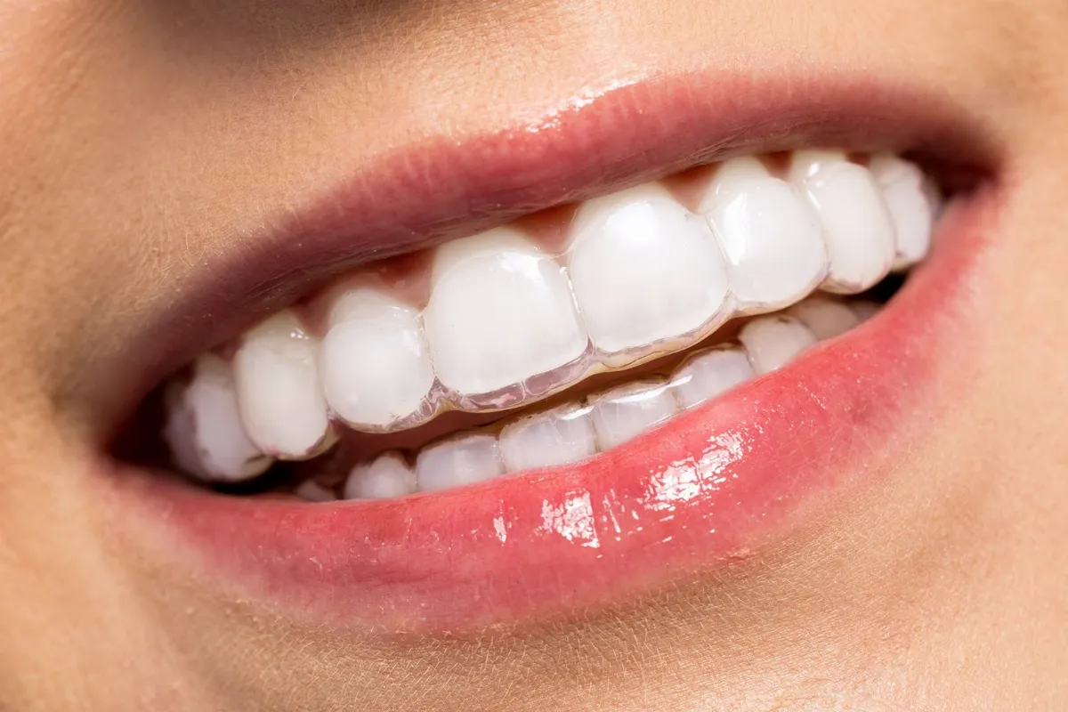 Cabinet Dentaire LZ — Dentiste et orthodontiste