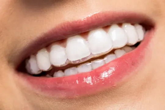 Cabinet Dentaire LZ — Dentiste et orthodontiste