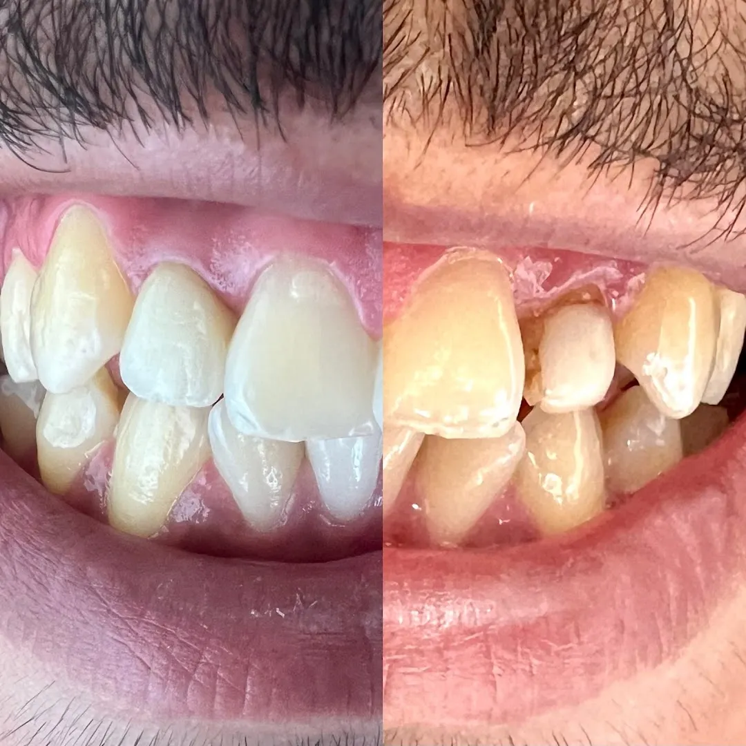 Centre Denti-Smile - Dr Qaidi Asmae et Dr Msougar Hamza