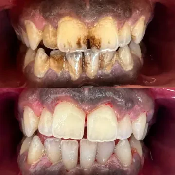 Centre Denti-Smile - Dr Qaidi Asmae et Dr Msougar Hamza
