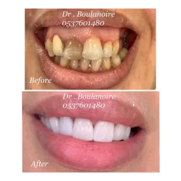 Clinique Dentaire Temara - Dr. Boulanoire