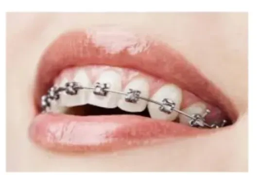 Elbekkali Bouchra (Orthodontiste)