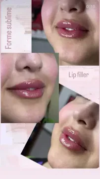 Dr Dassouli Ryme - Dermatologue, Médecine esthétique et Lasers