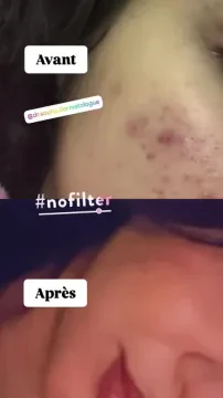Dr. Souha Belguenani, Dermatologue vénérologue
