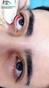 عيادة طب العيون د. حرشلي سناء