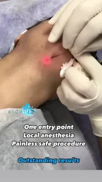 Dr Achraf El Idrissi Ellouadghiri - Dermatologue