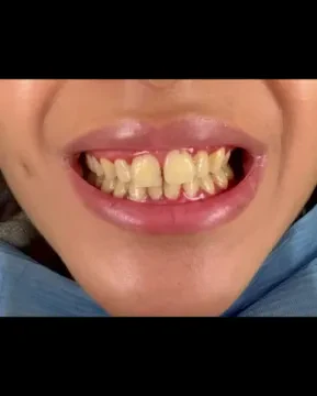 Dr Imane Akhmaij