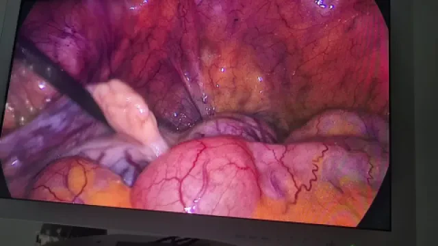 Dr Younès Benchelha — Gynécologue