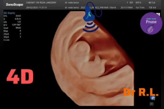 Dr Réda Lamzibri — Gynécologue Obstétricien