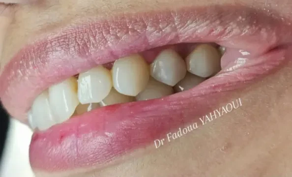 Dr Fadoua Yahyaoui - Cabinet Dentaire