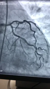 Dr Slaoui — Cardiologue interventionnel