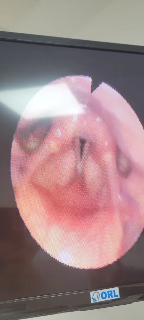 Dr Amine Lahcini - ORL