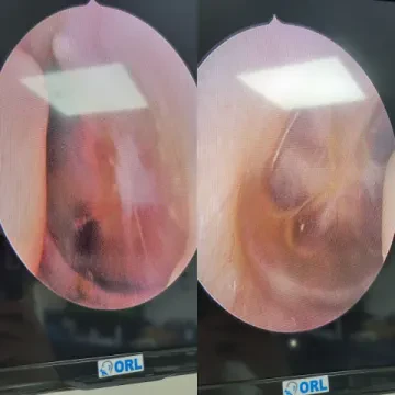 Dr Amine Lahcini - ORL