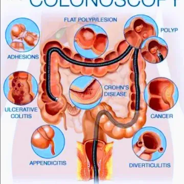 Centre Gastro-Entérologie Les Narcisses