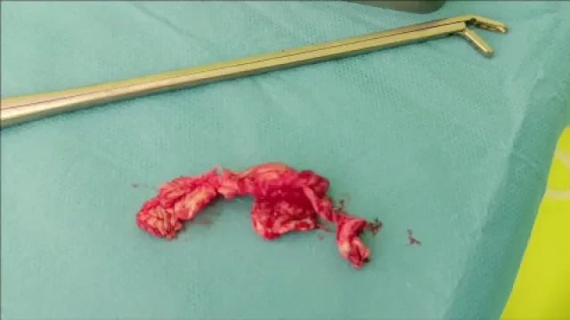 Dr EL Saqui - Neurochirurgien