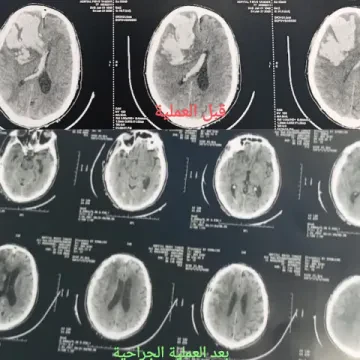 Dr EL Saqui - Neurochirurgien