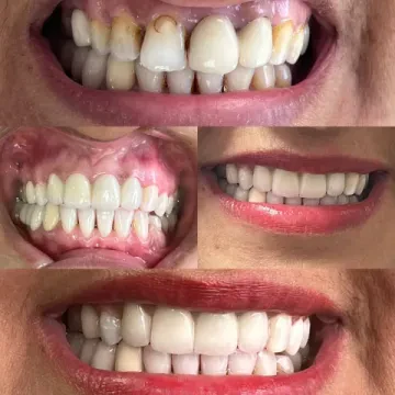 Cabinet Dentaire Dr Doha Ennarhech